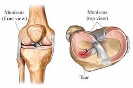 Anatomy of the Knee Joint